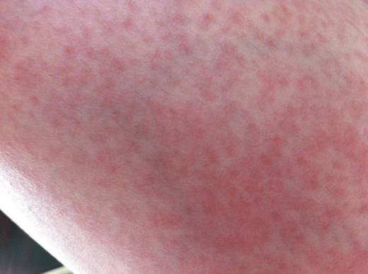 气血不足吃什么药调理最好呢 00d17ad5a0b345ac9b804ea6c1e79775.png