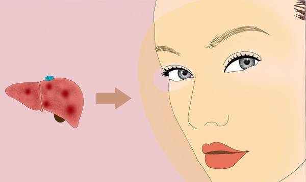 肝脏|脸能反映出肝的健康状况，脸部有哪些表现，或是肝病的信号？