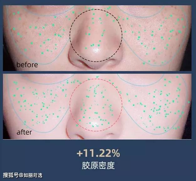 体重深扒：女生蜕变思路——不动刀8大具体案例，外在变化图解，大变活人魔法开场