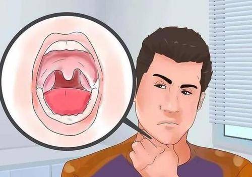 怎么快速解决口干口苦 2f3ec6d5bb73471db54196daaf3e61a6.jpeg