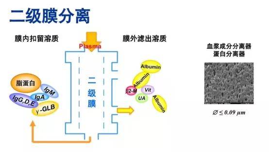 什么病需要做血浆置换 74e3a6d77fd34a16bef4f3c2fe972d50.jpeg
