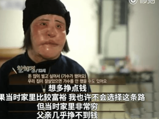 美貌整容狂人韩慧景：昔日美貌如花，整容后事业全毁，57岁遗憾离世