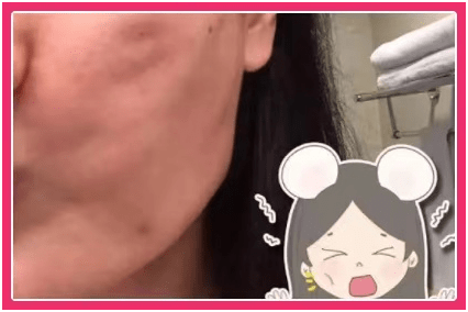 能量全面解析热拉提的功效与作用、热拉提plus做一次可以维持多久？