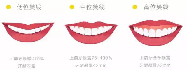 小天生图秒杀宋祖儿的天降紫微星，颜霸甜心可太绝了！