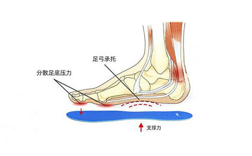 足部|鸿泰盛专属定制鞋垫功能介绍