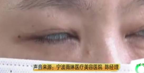 眼睛女子花2万8做眼部整容索赔遭拒，女子：眼睛无法闭上，我用胶带粘