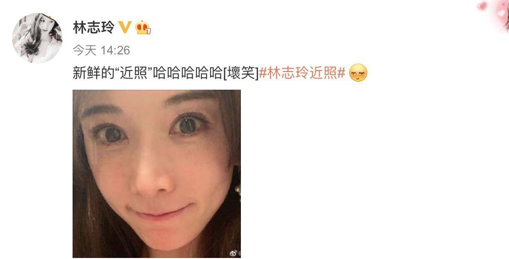 瘦但是脸部看起来肿 cf333c2d4e6d4e13b3e8c9cb7713f145.jpeg