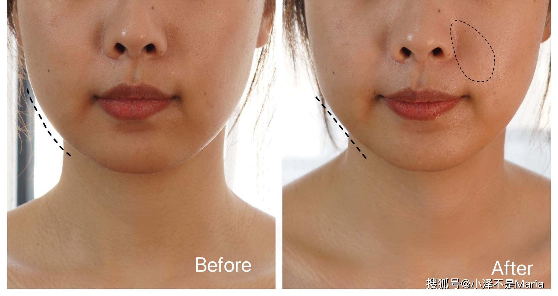 脸部别再用手挤痘痘了,痘痘肌的护肤经验今天我都帮你总结全了!