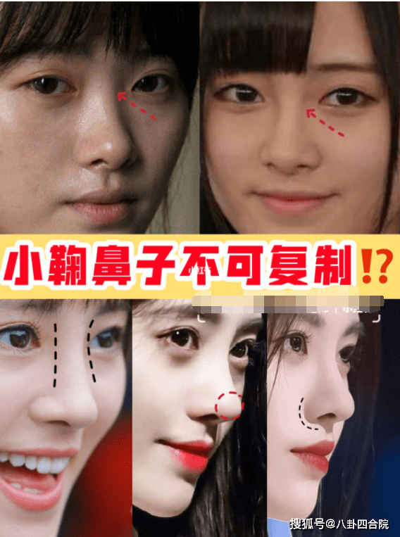 李小璐明星“假鼻子”大PK，帅哥变丑男，美女变女巫，谁越整越残？