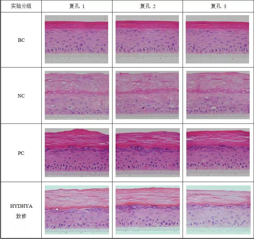功效水解小分子透明质酸钠-舒敏抗炎修复效果研究
