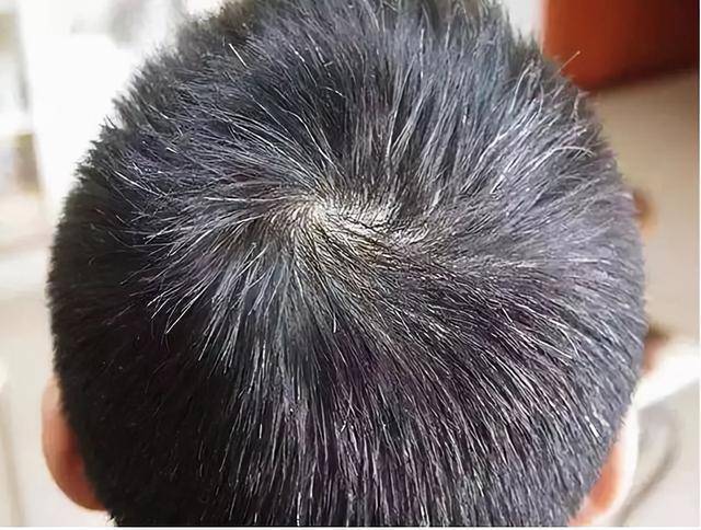 怎样增加头发生长 e9e29ae7b23148358fb1f2ba3bbaf701.jpeg