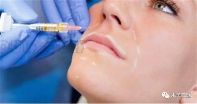 脸部打完干细胞脸部僵硬、干细胞的负面影响这么大么?