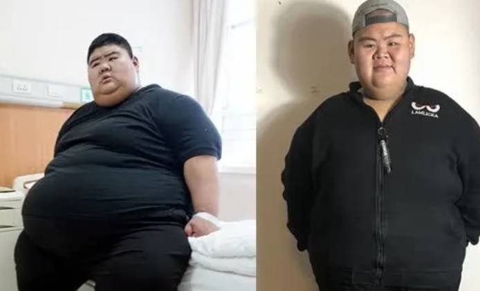 200多斤的大胖子减肥成了帅哥 af15810504fb4276bc49e6a2cc8b62dc.jpeg