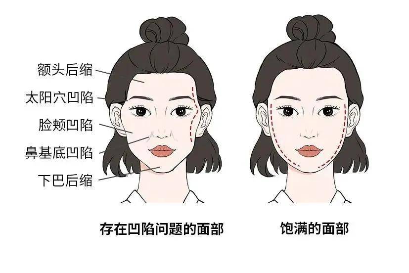 姐妹想要过年光彩照人？这些“应急”项目简直不要太香