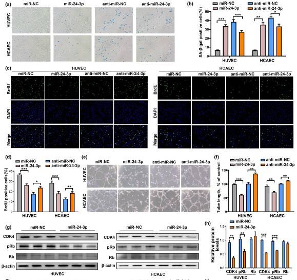 一区，IF=9.3|云序客户Aging Cell揭示circRNA调控内皮细胞衰老的分子机制