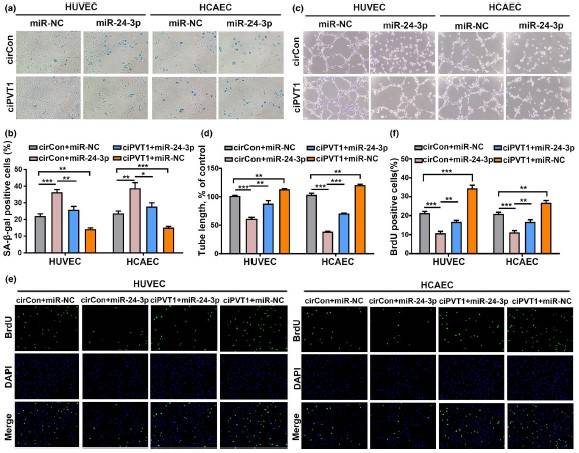 一区，IF=9.3|云序客户Aging Cell揭示circRNA调控内皮细胞衰老的分子机制