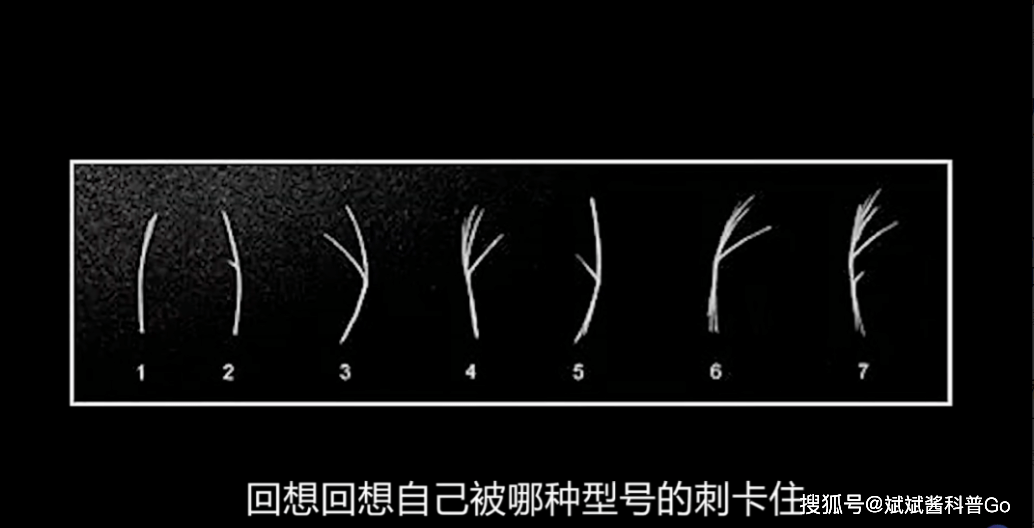 鲤形目鱼类普遍存在肌间刺,就是我们常见的淡水鱼,如鲫鱼,鲤鱼,草鱼