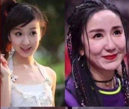 急救春节假期一周倒计时！时间紧迫，做点什么项目可以快速变美？