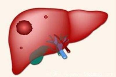 肝脏|肝病来袭并非“静悄悄”！这4类人，建议多多检查肝脏
