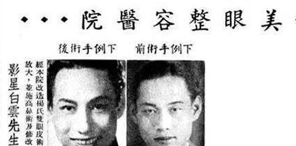 金条上世纪30年代上海整容机构，出入皆名流，一根金条才能割个双眼皮