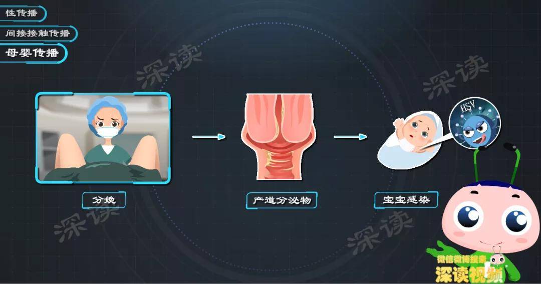 讲解原发性生殖器疱疹相关知识的简单介绍-第2张图片-鲸幼网