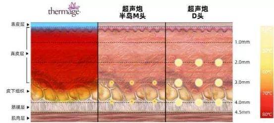 玛吉为什么她会从整形模板翻车成馒化代表?