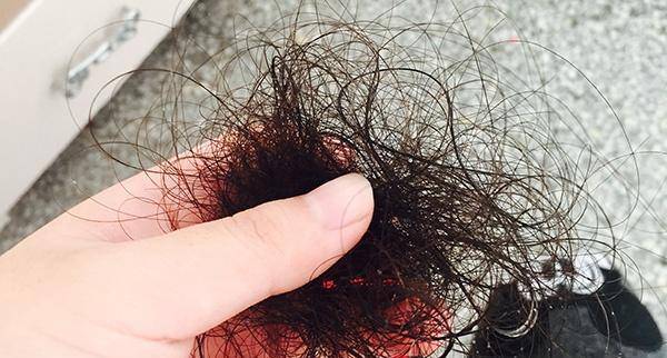 化疗后怎样让头发长得又快又好 25736883a09a4a16933b09b547c47836.jpeg