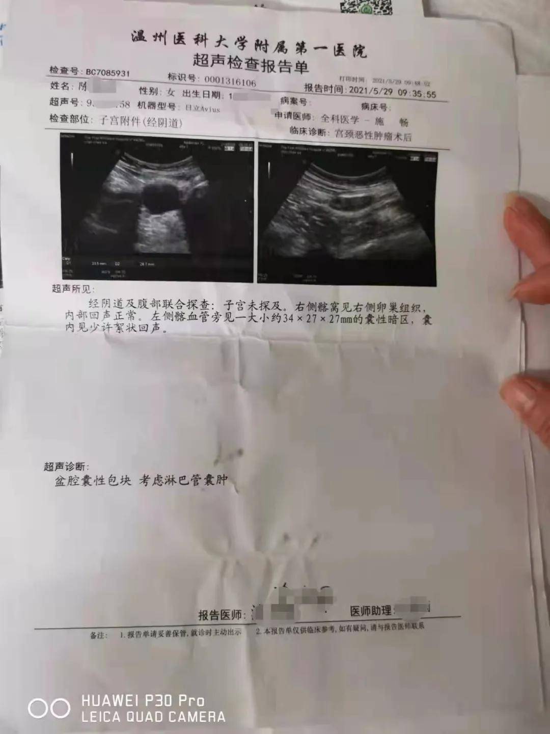 已切除了子宫体检报告却显示子宫正常迪安美生这是啥操作