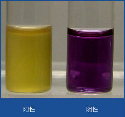 醇发酵试验3%氯化钠葡萄糖磷酸盐胨水(vp试验)61某些细菌能分解葡萄