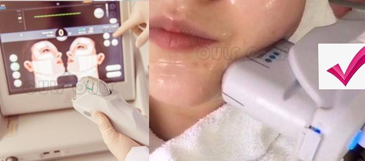 脸部天啊~做完超声刀脸凹陷了怎么办?超声刀后脸部凹陷如何修复?该注意什么?