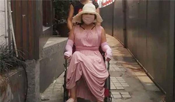 女孩子花费400多万,整容200多次,沦落到坐轮椅,乳房险被切除