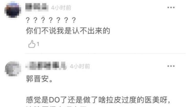 下巴明星频翻车医美需谨慎!有人脸变充气气球,有人下巴变天气预报