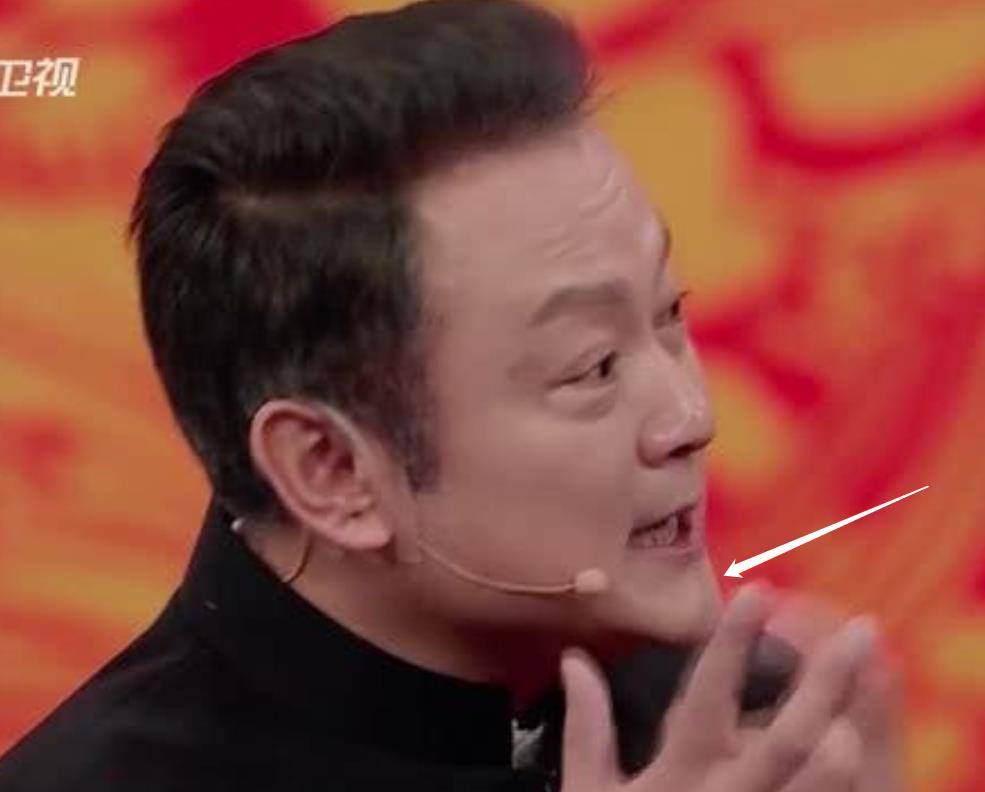 下巴明星频翻车医美需谨慎!有人脸变充气气球,有人下巴变天气预报