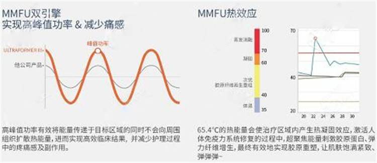 mm神普及：7d聚拉提美容的功效和副作用、原理、危害是什么？
