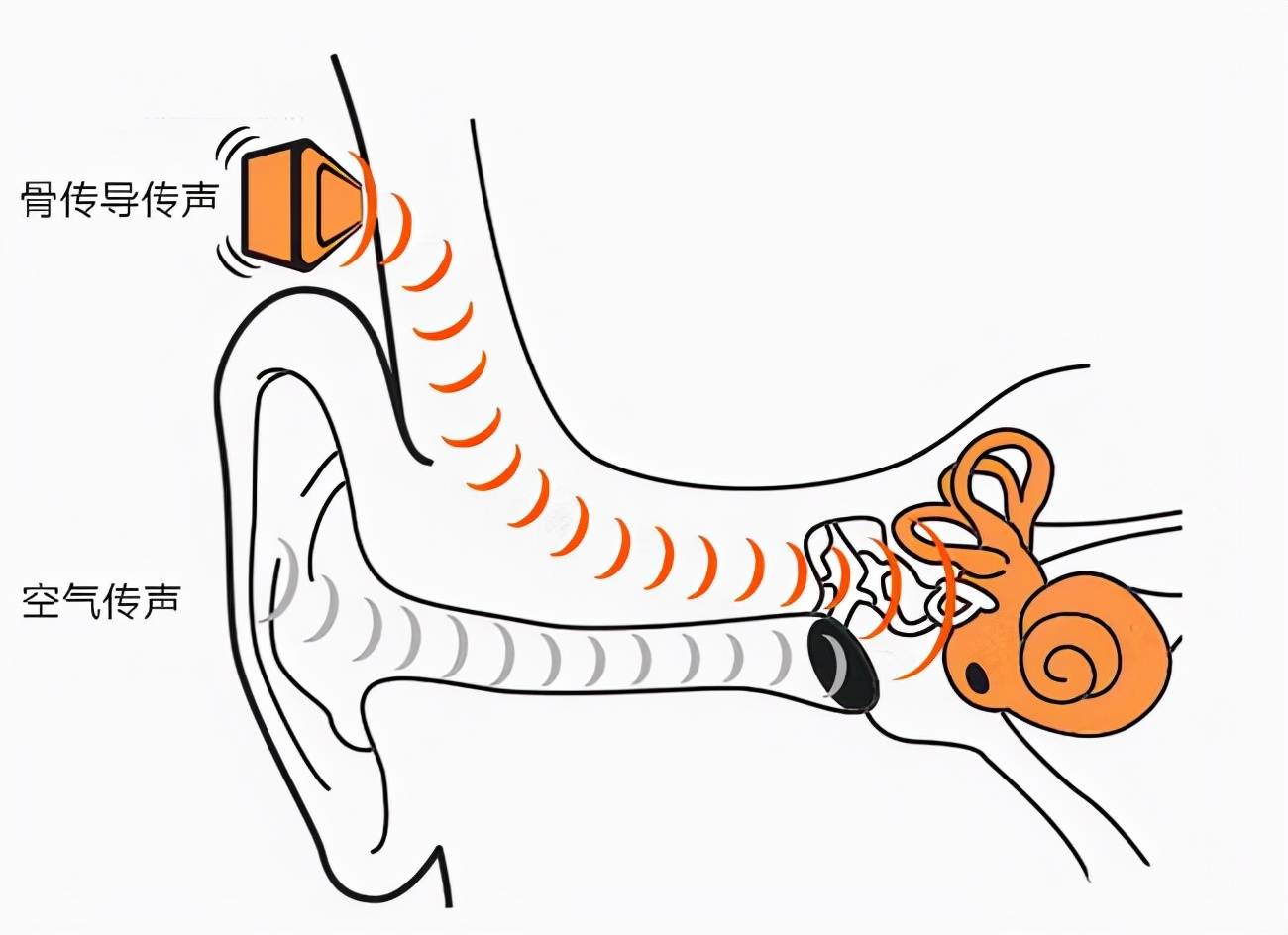 主要原理是將聲音轉化為不同頻率的機械振動,通過人的顱骨,骨迷路