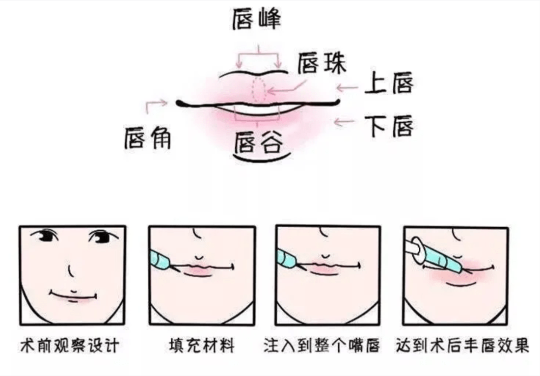 什么看着就唇唇欲动，想要一卿芳泽的唇，你见过吗？