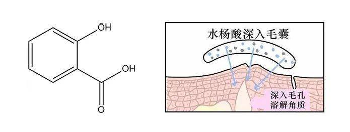 经验教程疑惑丨黑头不挤它自己会好吗？