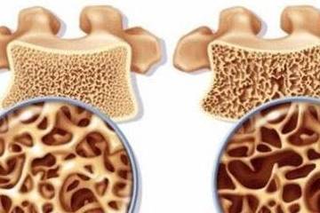 骨质|一天一个鸡蛋,这六件好事会找上你!营养生提醒:要避开三个误区