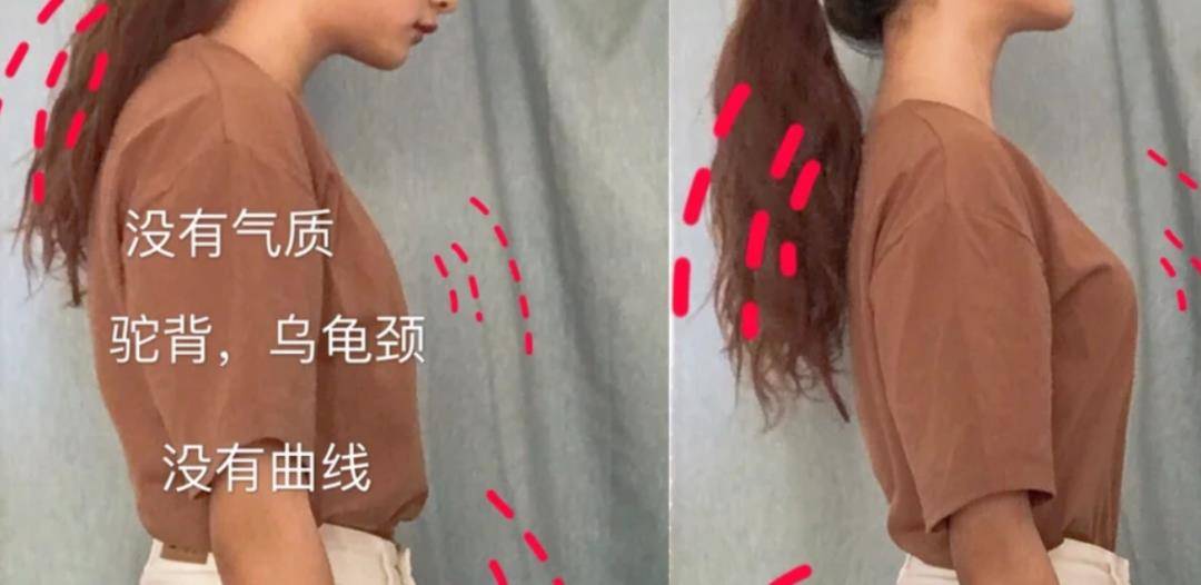 张雨绮32岁倪妮出道驼背照被嘲，“气质仙女”骗人：她压根不是女神