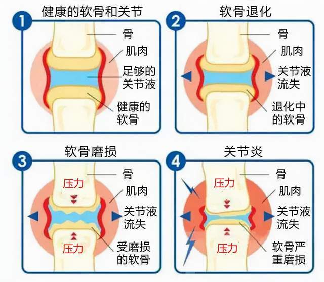 爬楼梯伤膝盖？学会这套方法，上下楼梯不费劲