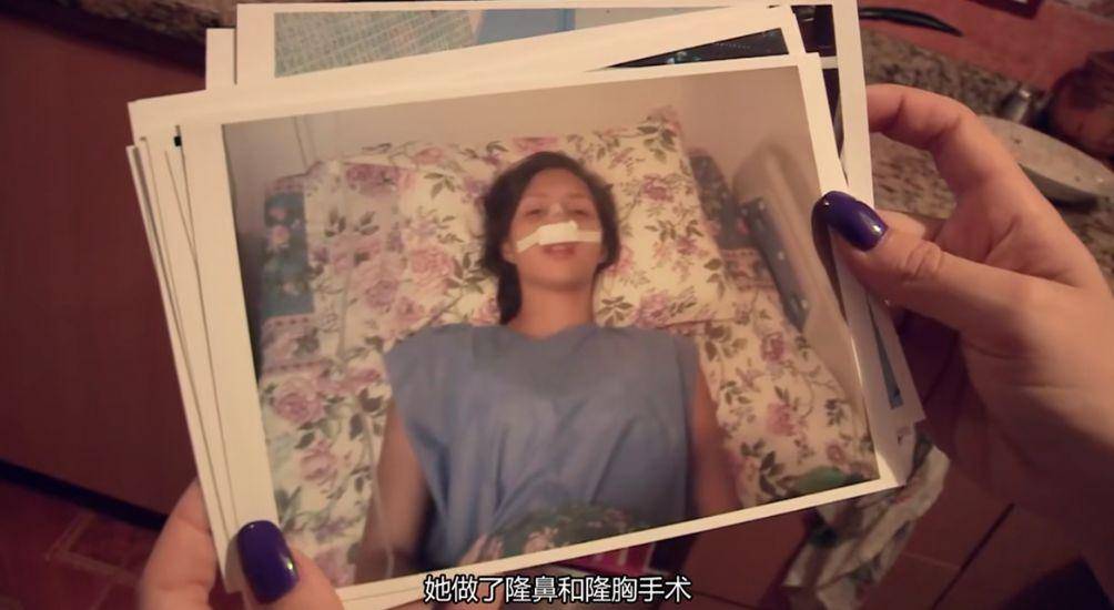 整形未成年整形、在舌头上缝塑料网，为了选美究竟可以多么疯狂？