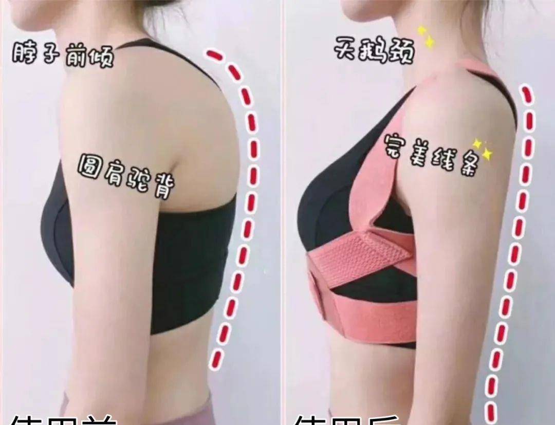 张雨绮32岁倪妮出道驼背照被嘲，“气质仙女”骗人：她压根不是女神