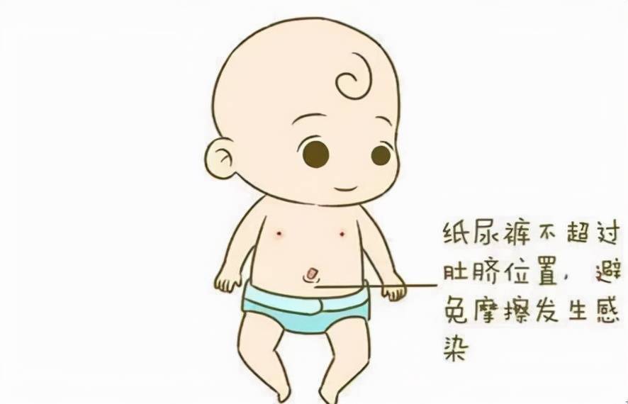 纸尿裤大小要适当,如果不是带凹槽的新生儿纸尿裤,腰部可以往回折
