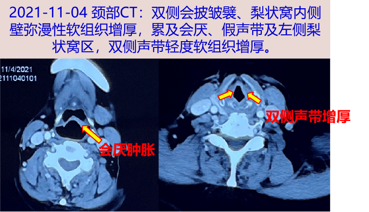 身体当中任何出现不良症状都要小心对待即使就医