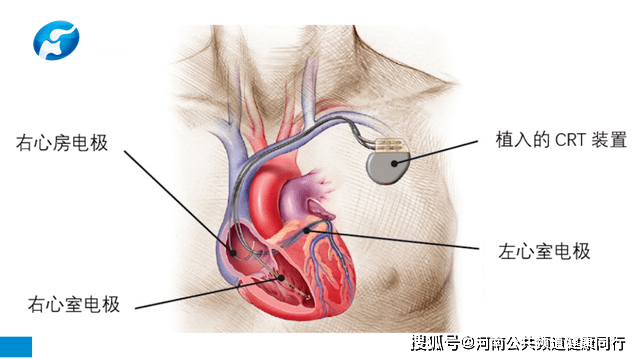 9026d2b15ee84e779b093f64ab93cb2a.png