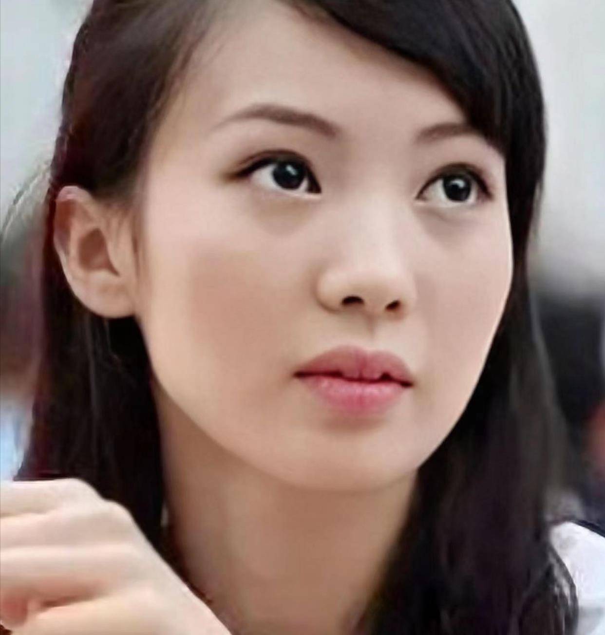 后遗症女明星为了变美，乱整鼻子留下的后遗症，至今悔恨终身