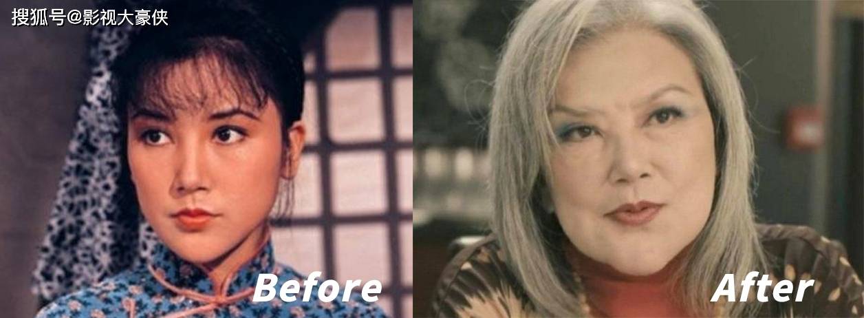 脸部被美容院毁掉的明星，娄艺潇秒变僵尸脸，张檬因整容葬送大好前途