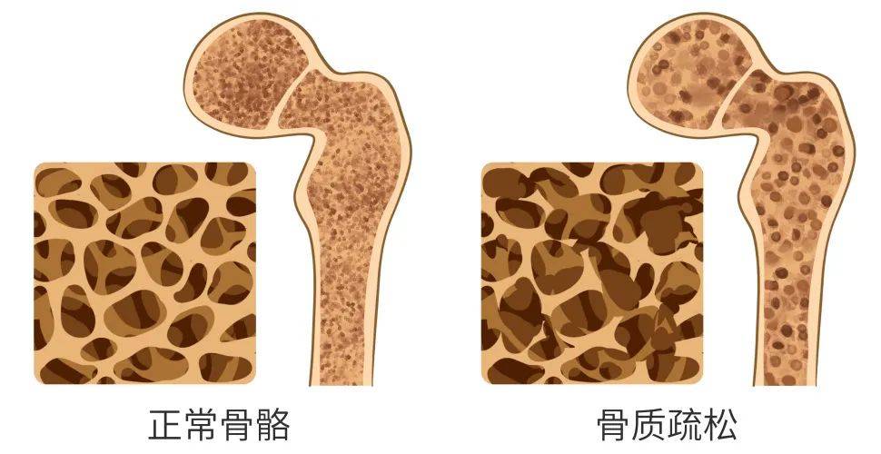 营养|更年期最该补的营养是？营养师定制食谱来喽