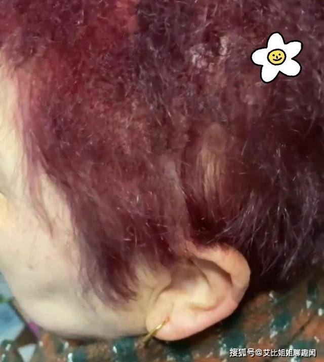小号大妈发量太少，用超小号发卡烫头，结果发卡拿不下来只得上钳子