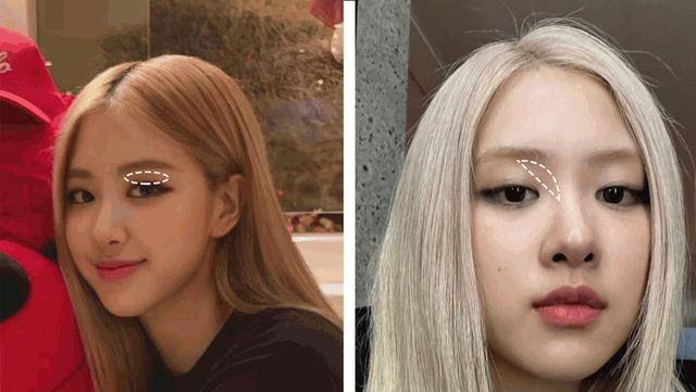 眼睛别再割双眼皮了!内双、肿眼泡的来啦!